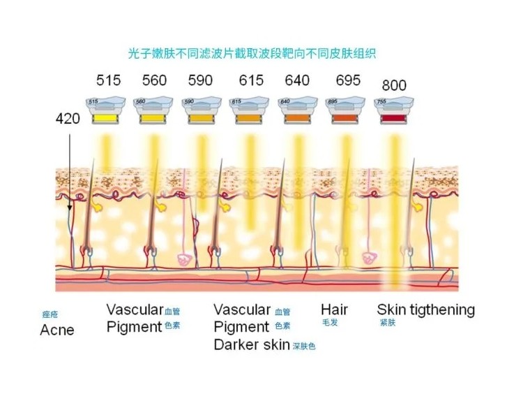 五大光子嫩膚技術(shù)（IPL、DPL、OPT、APT、BBL）及濾光片區(qū)別